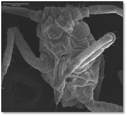electron microscope aphid image